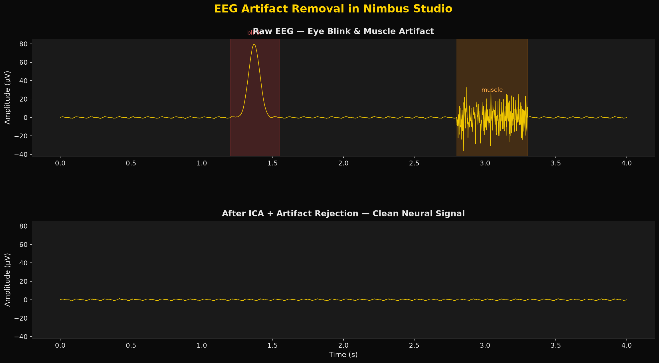 EEG signal before and after artifact removal: raw signal showing large blink and muscle artifacts on the left, clean neural oscillations on the right