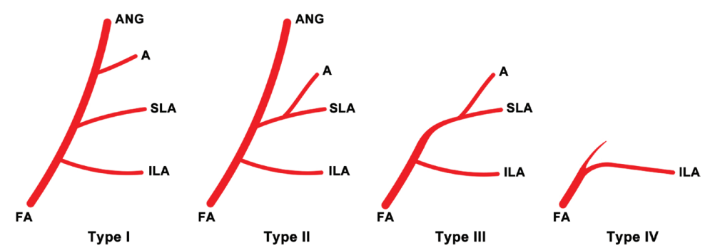 Lee et al., 2015. The different variations of SLA and Alar a. rising from Facial Artery.