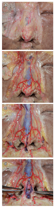 Lu et al., 2022. Cadaver Study