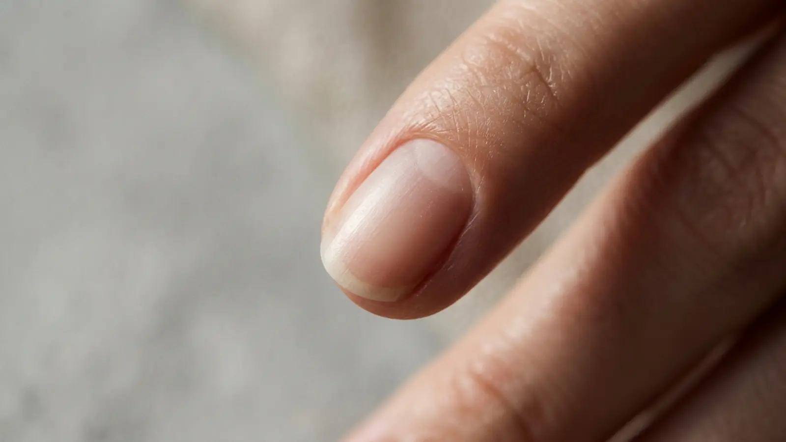 Allergie au gel : causes et prévention | Guide Expert
