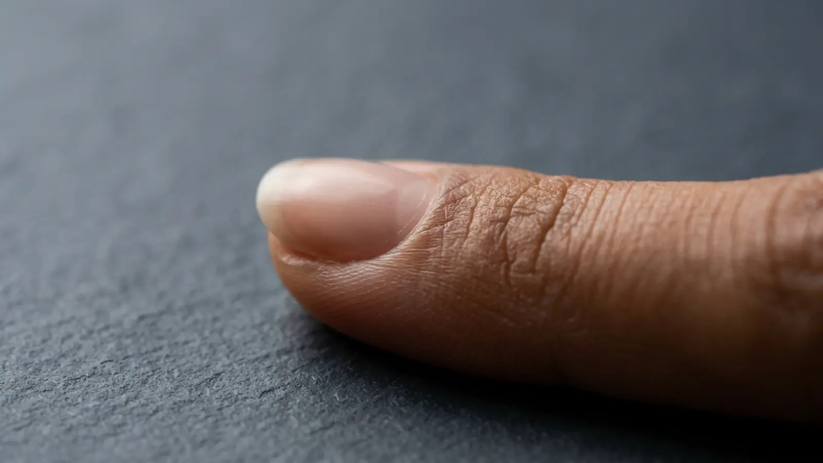 Hyponychium : Guide expert pour le protéger | Fénix Nails