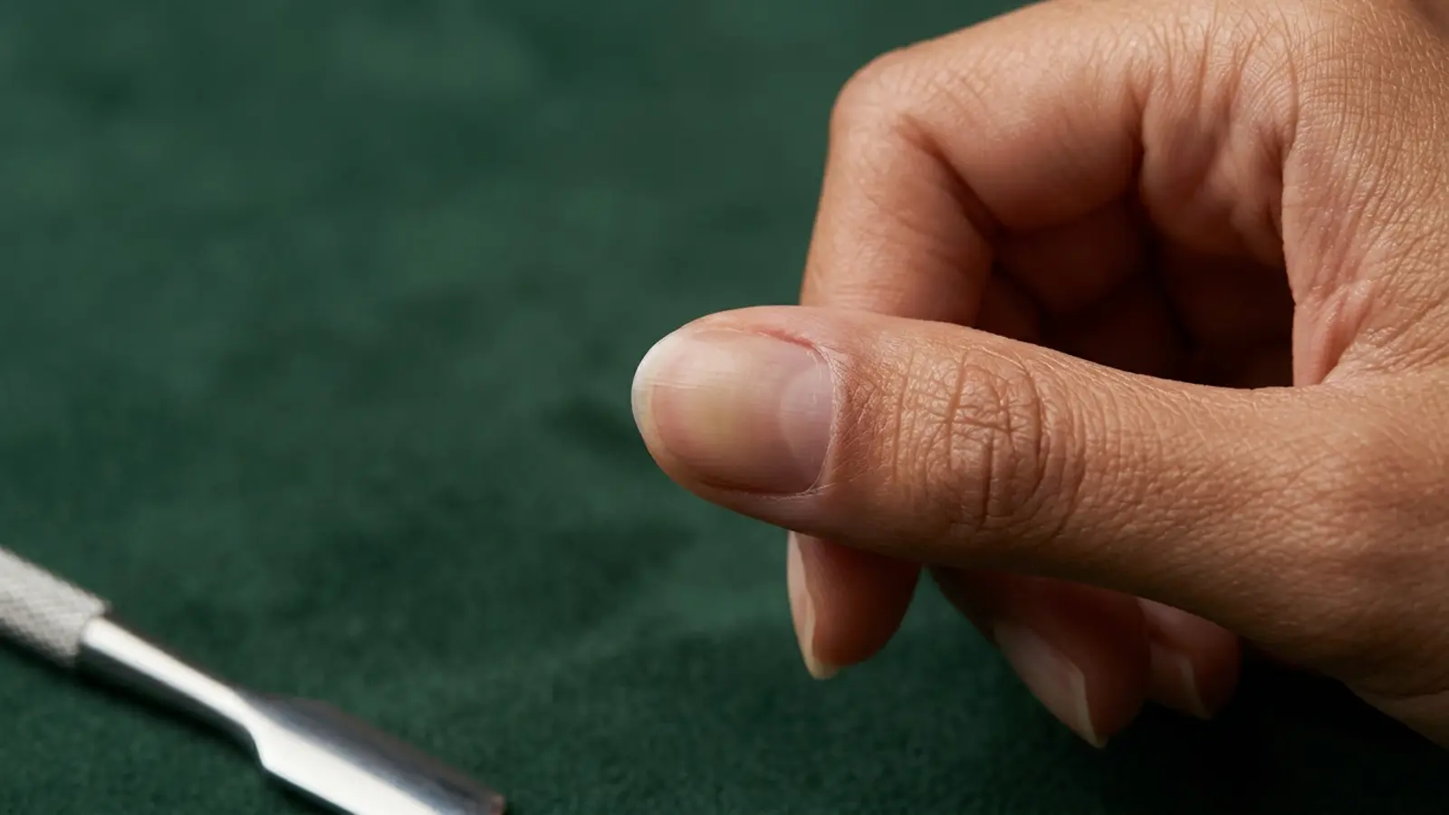 Ongle Vert Après Gel : Mycose ou Bactérie ? | Guide Expert