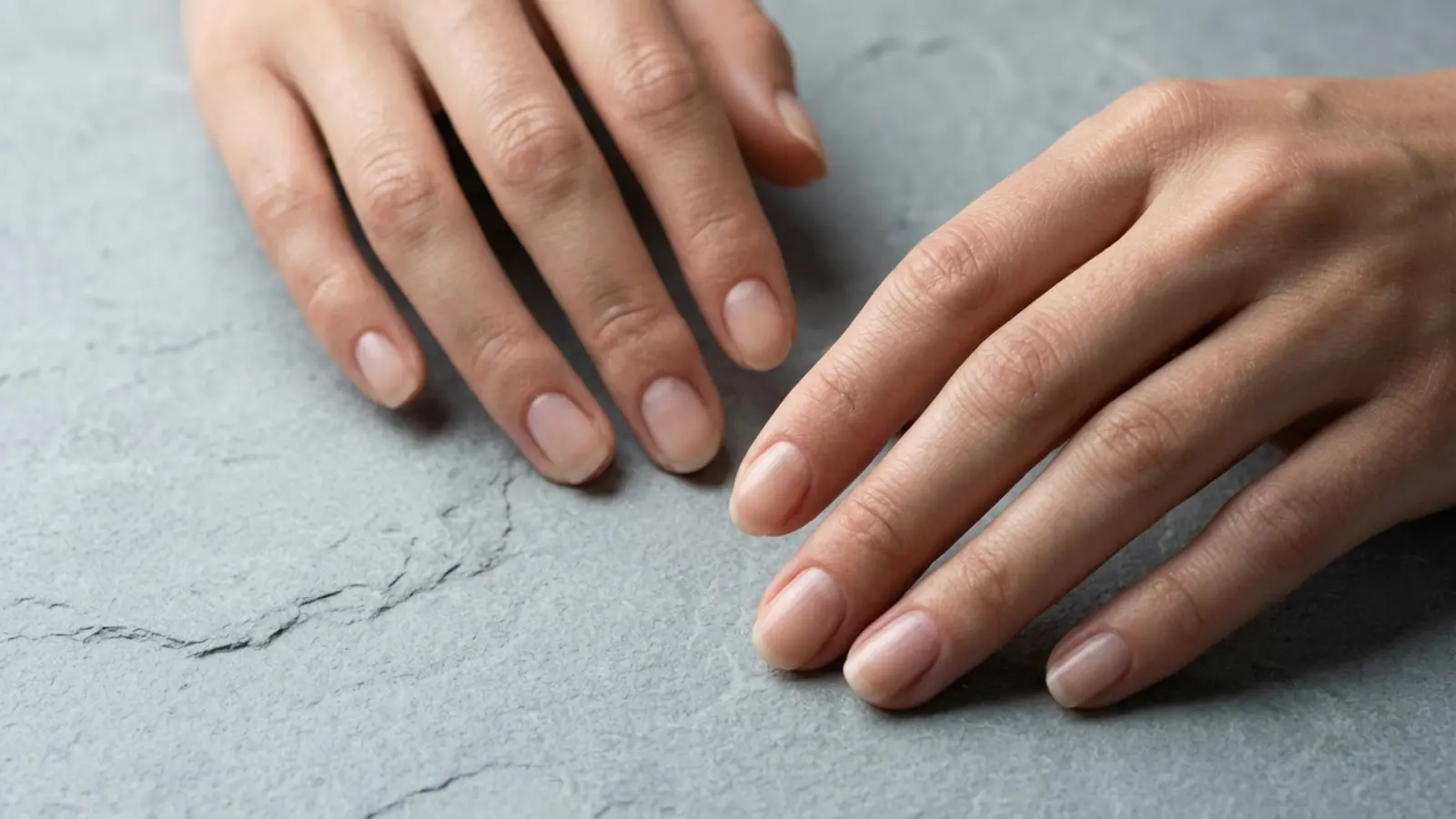 Plaque unguéale et adhérence du gel | Guide expert