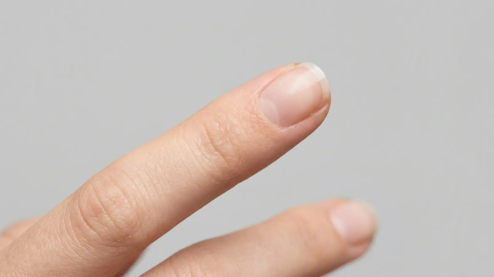 Tache verte sous gel | Guide Expert Pseudomonas