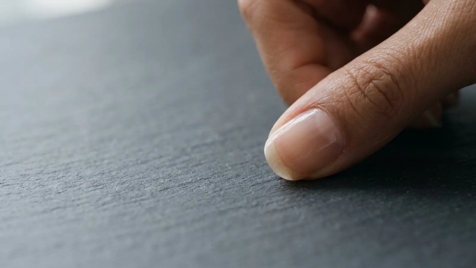 Guide Onycholyse : Prévenir le Décollement de l'Ongle